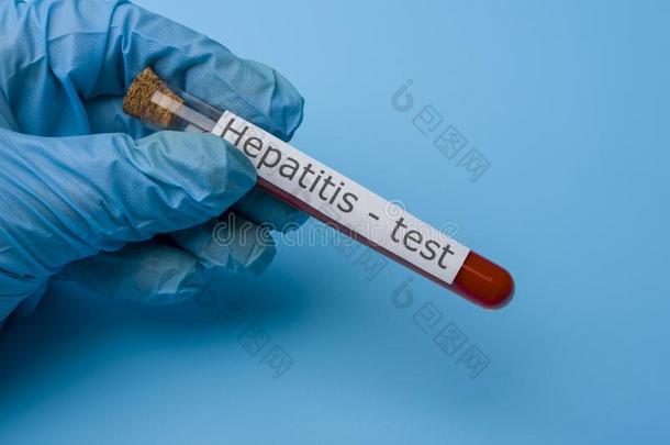 肝炎试验,血采用指已提到的人试验管