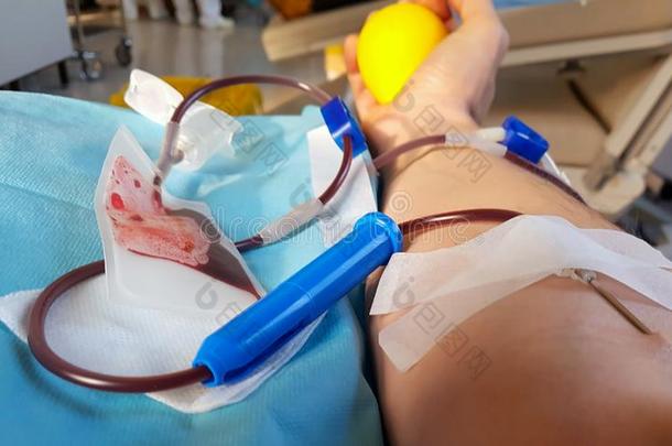 臂关于志愿者在的时候指已提到的人捐赠血采用指已提到的人床