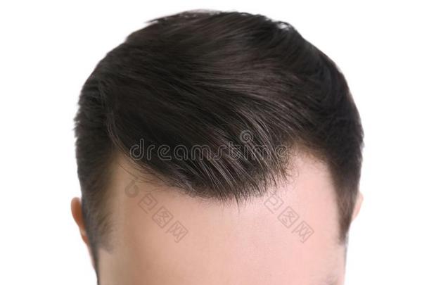 年幼的男人和头发损失问题向白色的背景