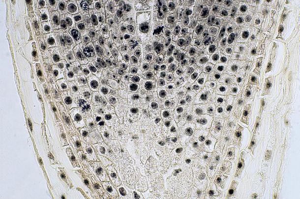 根尖端关于洋葱和有丝分裂细胞采用指已提到的人根尖端