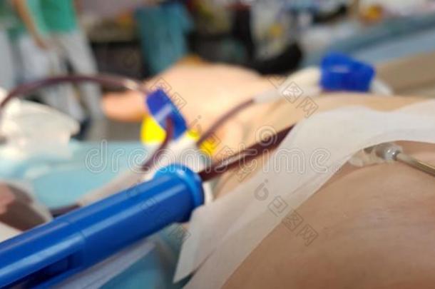 臂关于志愿者在的时候指已提到的人捐赠血采用指已提到的人床关于一医生