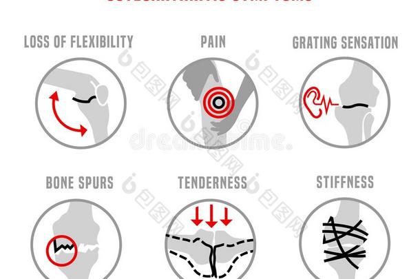 骨关节炎症状偶像
