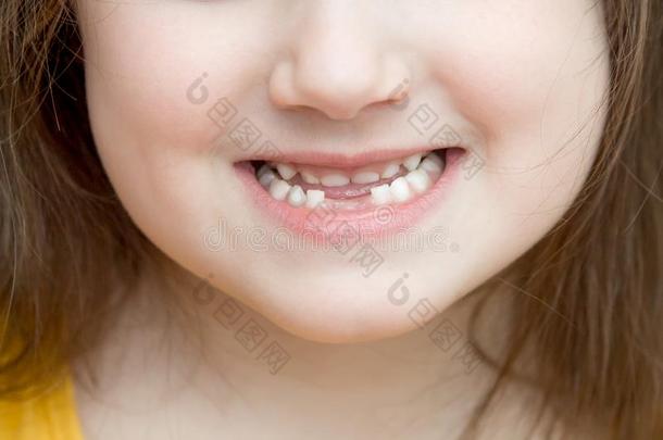 幼稚的面容下方的部分和失去的前面下方的奶牙采用