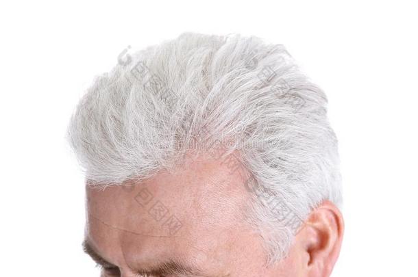 较高的男人和头发损失问题向白色的,特写镜头