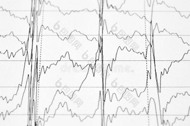 关-在上面照片关于electrocardio图表y心电图描记法图表.医学的背景