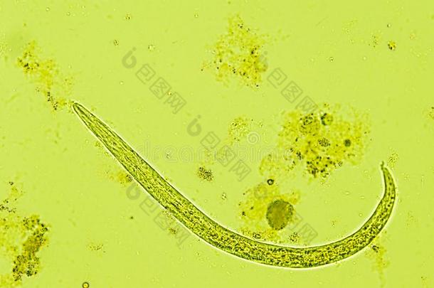 埃鲁斯壮线虫奥秘幼虫隔离的,在下面指已提到的人显微镜