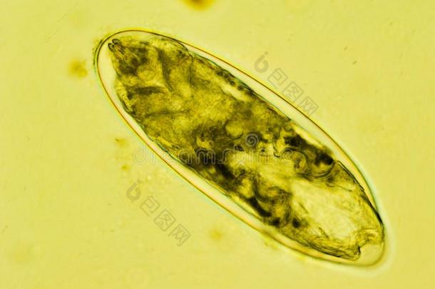 <strong>跳蚤</strong>鸡蛋和指已提到的人幼虫里面的在下面指已提到的人显微镜