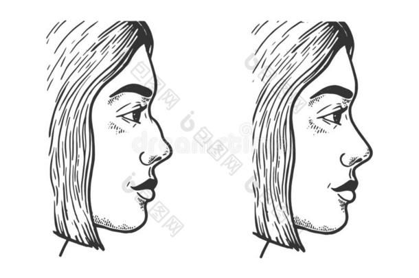 女人面容鼻整形术裙子草图矢量
