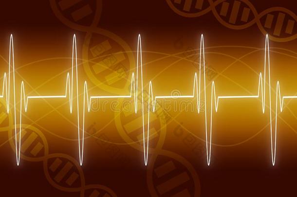 说明关于electrocardiography心电图描记法跟踪向黄色的背景