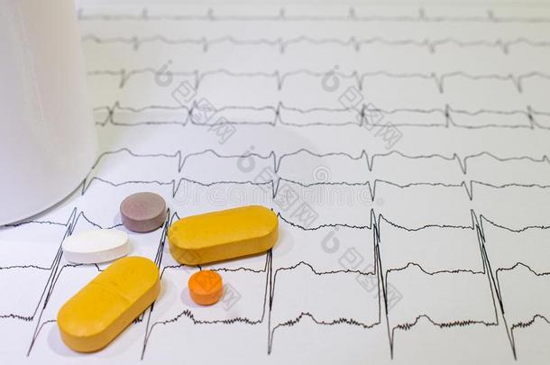 心电图和布鲁加达综合征.有色的药丸向一electrocardiography心电图描记法