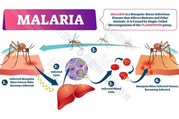 <strong>疟疾</strong>矢量说明.蚊子咬血被感染的疾病