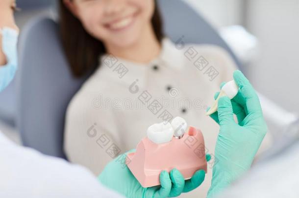 牙科医生讲解牙取出