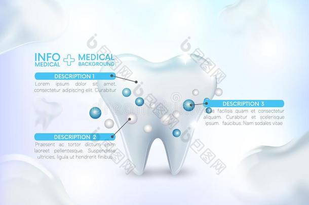 健康的牙,医学的信息图,在下面保护,牙极少的量