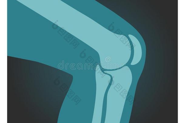 字母x-射线射手关于膝,人身体,<strong>骨骼</strong>关于腿,X光线照相术,vectograp<strong>矢量</strong>图