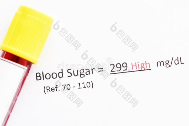 反常的高的血食糖试验结果