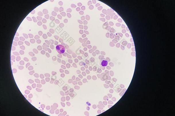 比较白色的血细胞嗜酸粒细胞和淋巴细胞