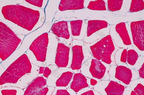 组织学的样品有沟痕的肌肉薄纸在下面指已提到的人显微镜.