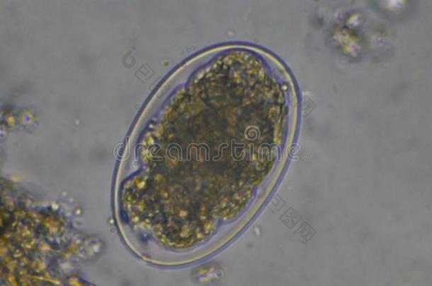 宏指令钩虫卵寄生物采用凳子exam采用ation