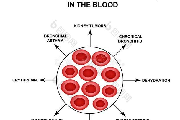 原因关于增加的红色的血细胞.细胞红细胞.家