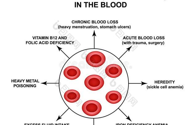 原因关于减轻体重法红色的血细胞.细胞红细胞.血红蛋白