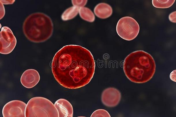 指已提到的人疟疾-被感染的红色的血细胞