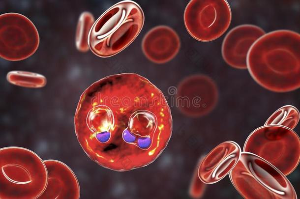 指已提到的人<strong>疟疾</strong>-被感染的红色的血细胞