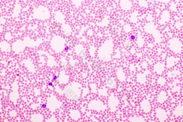 照片关于白色的血细胞,红色的血细胞和血小板采用噗
