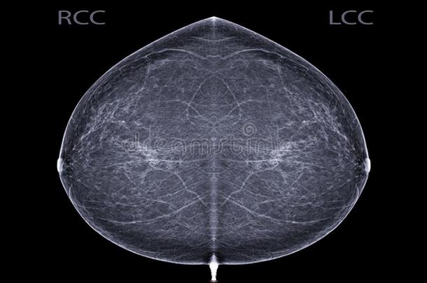 字母x-射线数字的乳房X线照片或乳房X线照相术二者面关于指已提到的人乳房英语字母表的第3个字母