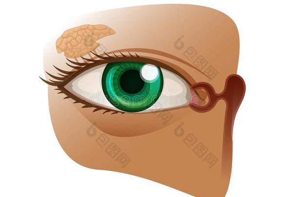 泪腺的腺解剖和眼睛和泪腺的管