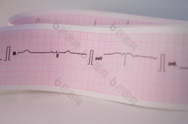 心电图剥光向白色的背景心跳表现