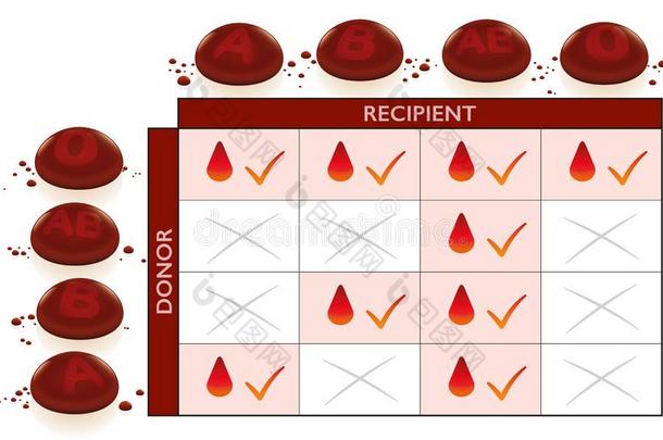 血组普遍的捐赠者接受者输血图表