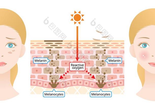 机制关于皮细胞翻滚说明.黑色素和黑变病者