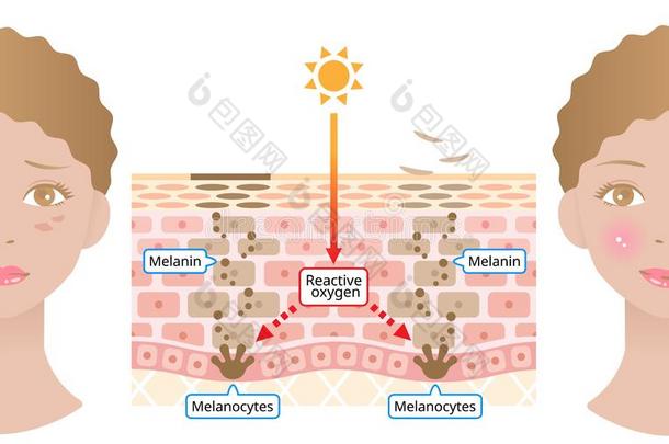 人皮机制关于黑色素和面部的黑暗的地点.信息记录