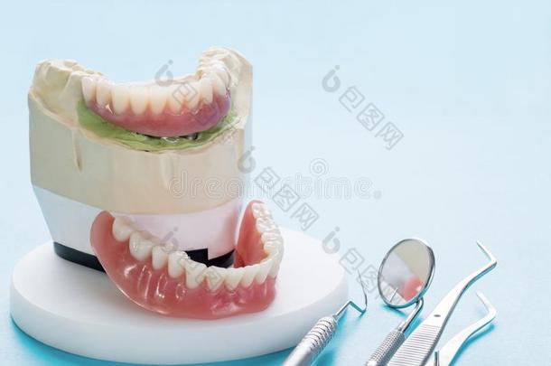 牙齿的移植物使工作是（be的三单形式完整的和准备好的向使用.