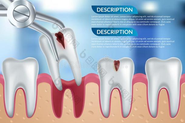 牙齿的观念.矢量海报.牙医业和口腔病学
