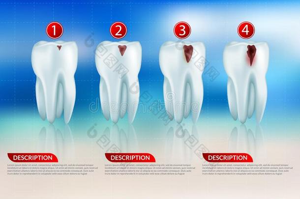 牙齿的观念.矢量海报.牙医业和口腔病学