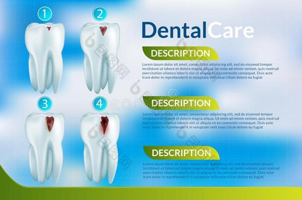 牙齿的观念.矢量海报.牙医业和口腔病学