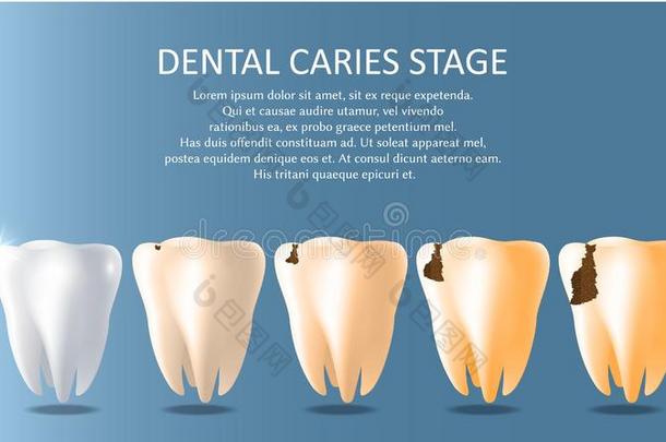 牙齿的龋齿台矢量医学的海报横幅样板