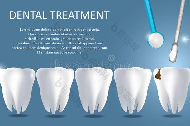 牙齿的治疗矢量医学的海报横幅样板