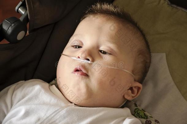 婴儿男孩和大脑的<strong>瘫痪</strong>是（be的三单形式获得氧经过鼻的弹簧