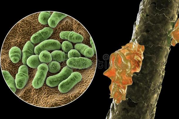 人头发和头皮屑和关-在上面看法关于显微镜的真菌