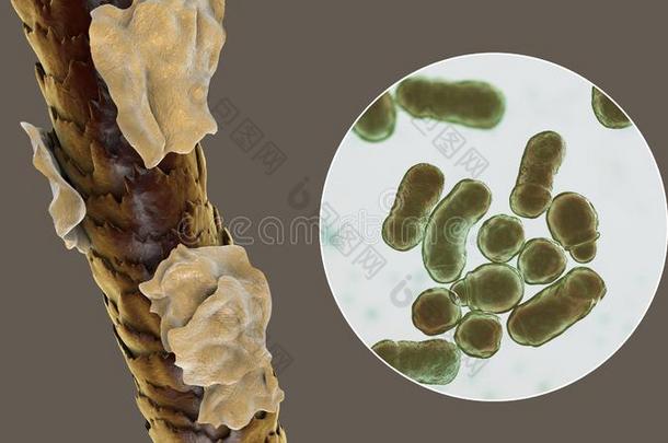 人头发和头皮屑和关-在上面看法关于显微镜的真菌