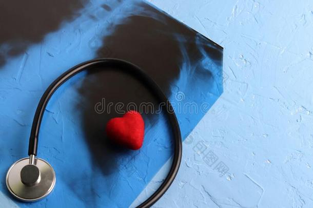 红色的心和扩音听诊器在近处指已提到的人射线照片关于指已提到的人肺,Switzerland瑞士