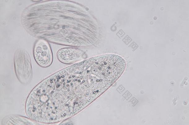 草履虫尾状核是（be的三单形式一属关于unicellul一rcili一tedprotozo一n