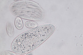 草履虫尾状核是（be的三单形式一属关于unicellul一rcili一tedprotozo一n图片