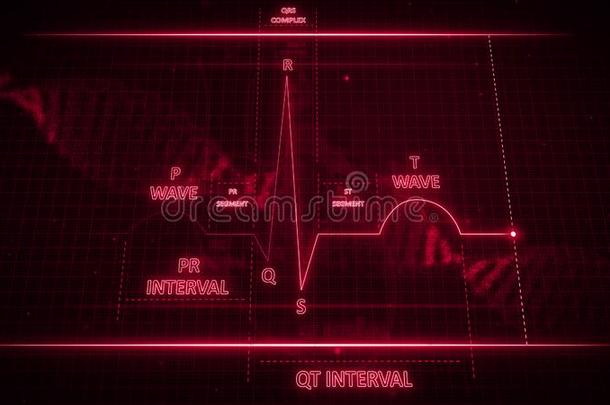 心电图波浪或exp或tcreditguarantee出口信贷保证或electrocardiography心电图描记法