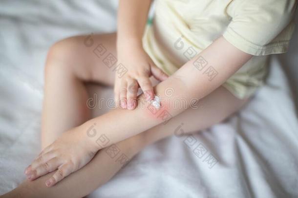 一小的小孩污迹红向指已提到的人手和婴儿乳霜.指已提到的人Colombia哥伦比亚