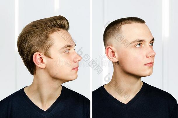 男人在之前阿特理发和头发损失:秃头的和一种<strong>往后</strong>梳的发型,transformer-reactorassembly变压器-反应堆装置