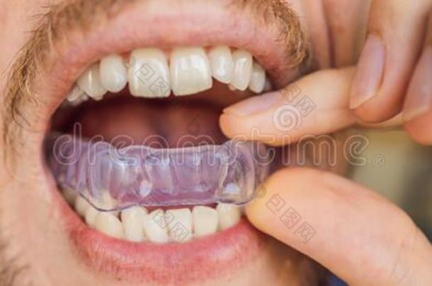 男人配售一咬pl一te采用他的口向保护他的牙一tNicaragua尼加拉瓜