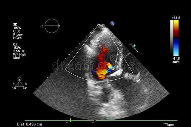 影像关于指已提到的人<strong>心</strong>在的时候经食道的超声.